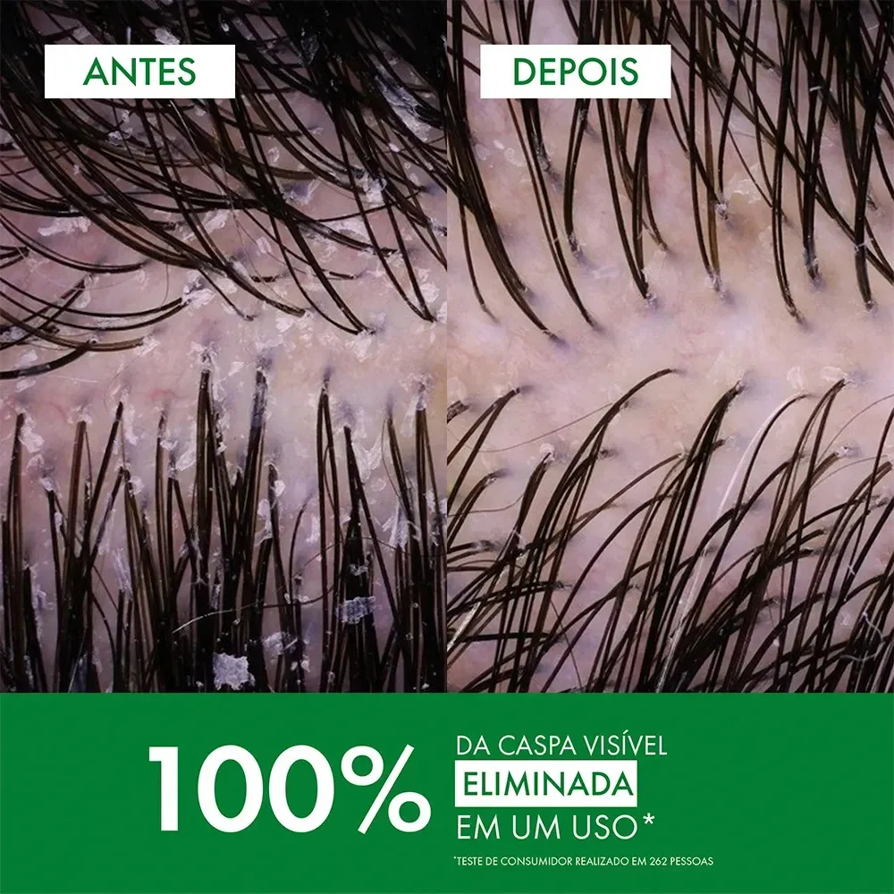 Shampoo Anticaspa Cabelos Normais a Oleosos, Vichy - outro ângulo - foto 4 de 4